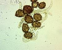 Image of Fossombronia foveolata
