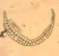 Leucobryum albidum image