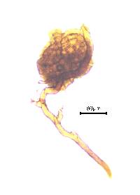 Imbribryum gemmiparum image